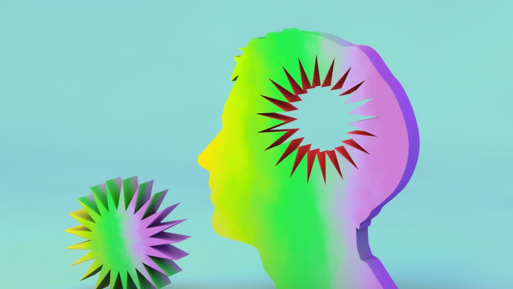 artwork depicting migraines and migraine treatment