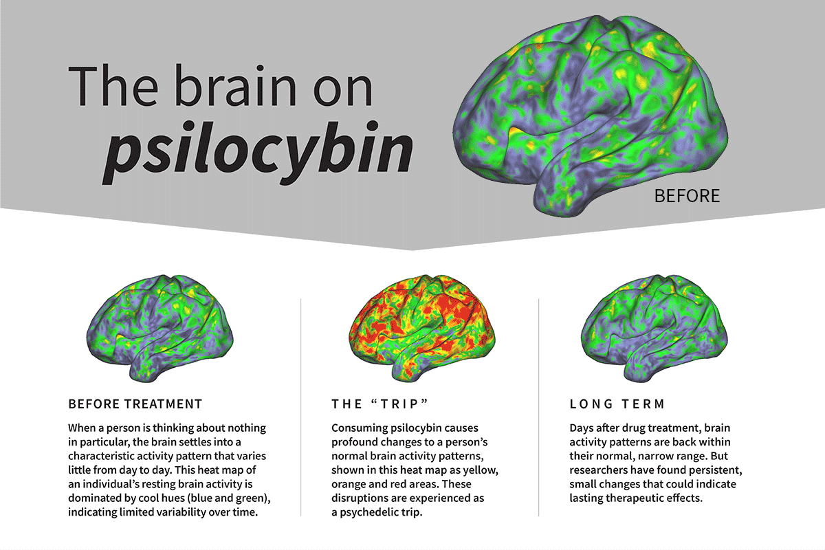A gif showing how the brain changes on psilocybin.